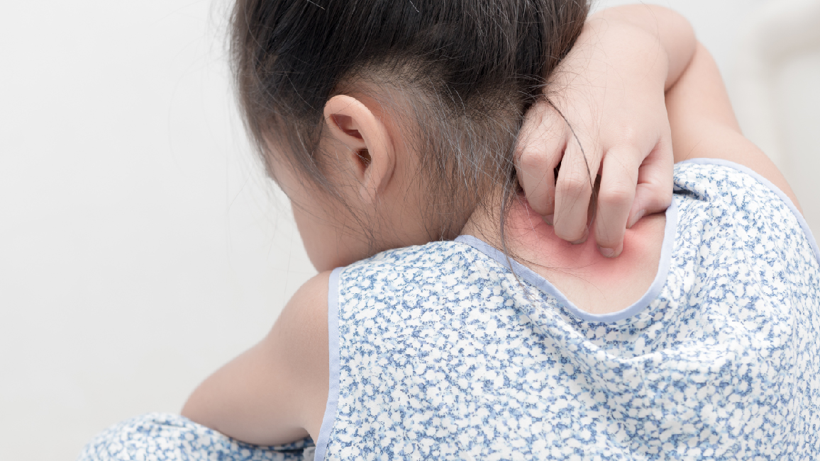 Get to know more with Atopic dermatitis
